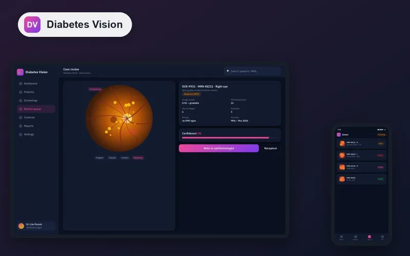 Diabetes Vision Detector — AI fundus analysis